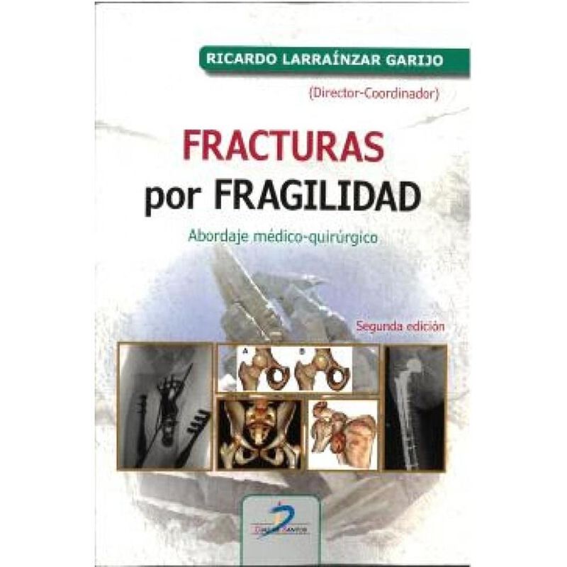 Fracturas por fragilidad image number null
