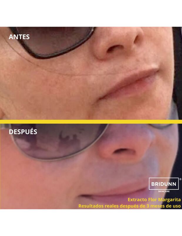 Crema Despigmentante Facial Natural BRIDUNN Man... image number null