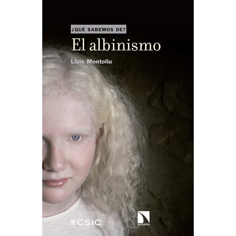 El Albinismo &iquest;Qu&eacute; sabemos de? image number null