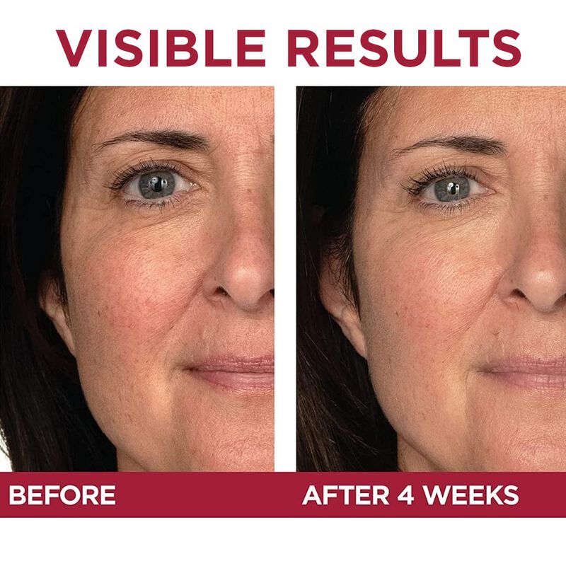 Crema De Ojos L'oreal Paris Revitalift Triple P... image number null