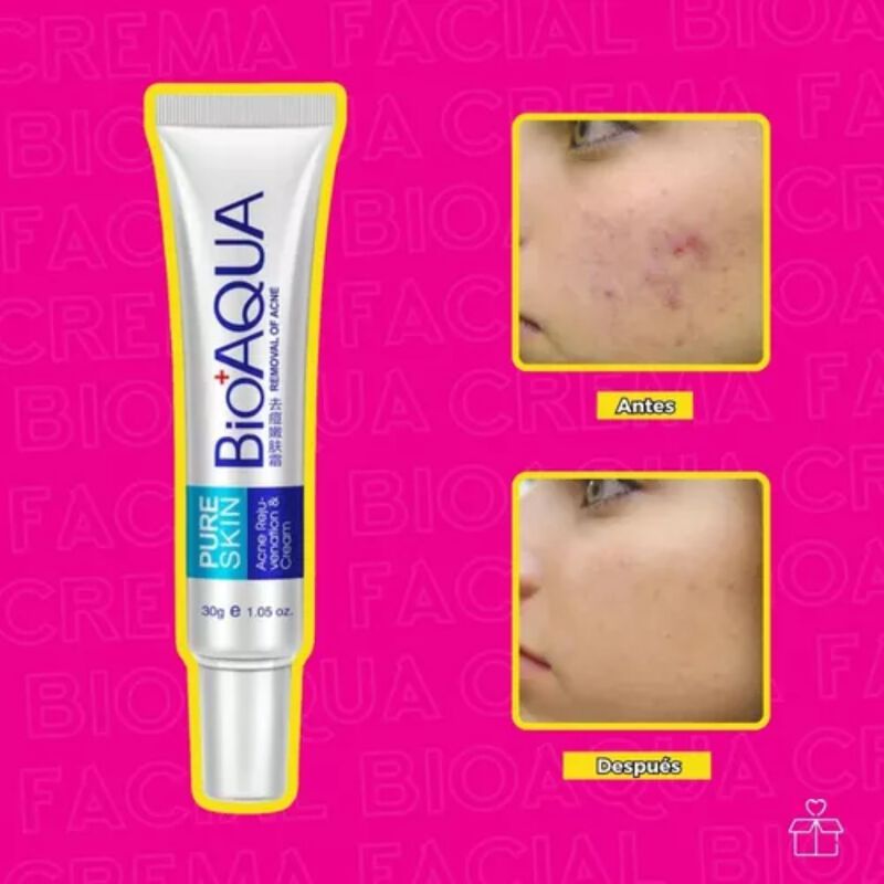 Crema Anti &Aacute;cne Bioaqua Pure Skin Cicatrices Co... image number null
