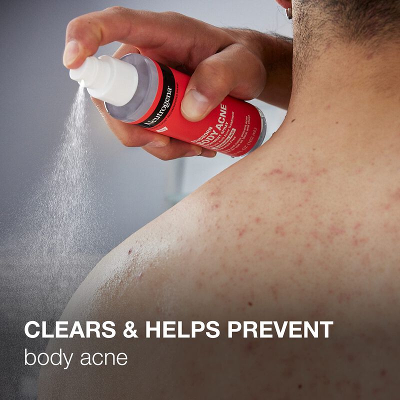 Spray Para El Acn&eacute; Neutrogena Stubborn Con &Aacute;cid... image number null