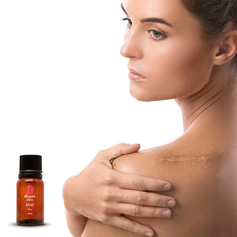 Aceite Esencial Puro Rosa 10 ml 100% Puro y Org... image number null