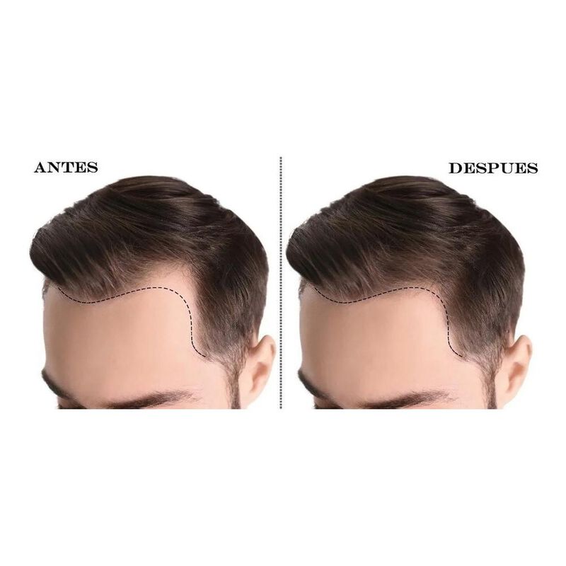 Kit B&aacute;lsamo De Crecimiento Y Sistema Capilar Co... image number null