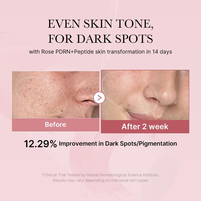 T&oacute;nico Medicube Pdrn Pink Peptide Pink Glow 250... image number null