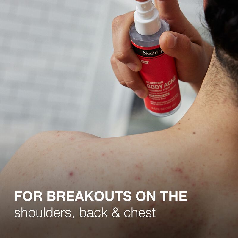 Spray Para El Acn&eacute; Neutrogena Stubborn Con &Aacute;cid... image number null