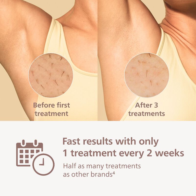 Depiladora Philips Lumea 8000 Ipl De Depilaci&oacute;n... image number null