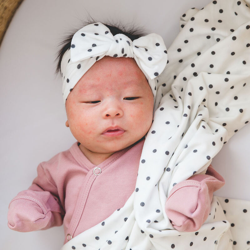 Banda Willow image number null